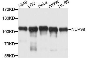Western blot analysis of extracts of various cell lines, using NUP98 antibody. (NUP98 Antikörper  (AA 621-920))