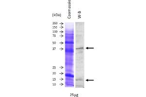 Image no. 1 for anti-Superoxide Dismutase 1, Soluble (SOD1) antibody (ABIN3197496) (SOD1 Antikörper)