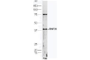 Human Raji cell lysates probed with Rabbit Anti-RNF39 Polyclonal Antibody, Unconjugated  at 1:5000 for 90 min at 37˚C. (RNF39 Antikörper  (AA 182-230))