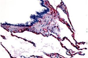 Human Respiratory Epithelium, Bronchial Smooth Muscle, and Alveoli (formalin-fixed, paraffin-embedded) stained with CAV1 antibody ABIN213405 at 3 ug/ml followed by biotinylated goat anti-rabbit IgG secondary antibody ABIN481713, alkaline phosphatase-strepta . (Caveolin-1 Antikörper  (N-Term))