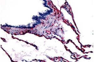 Human Respiratory Epithelium, Bronchial Smooth Muscle, and Alveoli (formalin-fixed, paraffin-embedded) stained with CAV1 antibody ABIN213405 at 3 ug/ml followed by biotinylated goat anti-rabbit IgG secondary antibody ABIN481713, alkaline phosphatase-strepta .
