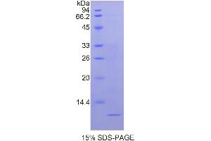 SDS-PAGE analysis of Human Nucleophosmin Protein.