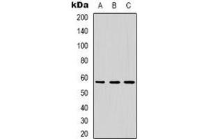 Western blot analysis of Dyskerin expression in MCF7 (A), HepG2 (B), Jurkat (C) whole cell lysates.