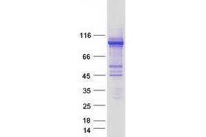 Western Blotting (WB) image for Ubiquitin Protein Ligase E3A (ube3a) (Transcript Variant 3) protein (Myc-DYKDDDDK Tag) (ABIN2734879)