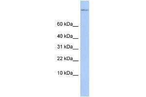 WB Suggested Anti-TSC22D1 Antibody Titration:  0. (TSC22D1 Antikörper  (Middle Region))