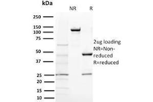 SDS-PAGE Analysis Purified BAP1 Mouse Monoclonal Antibody (BAP1/2431). (BAP1 Antikörper  (AA 191-326))