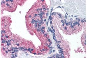 Human Prostate (formalin-fixed, paraffin-embedded) stained with B2M antibody ABIN364376 at 10 ug/ml followed by biotinylated anti-mouse IgG secondary antibody ABIN481714, alkaline phosphatase-streptavidin and chromogen. (beta-2 Microglobulin Antikörper)