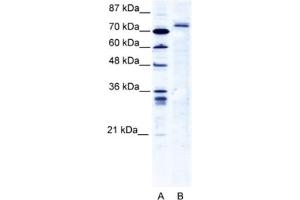 Western Blotting (WB) image for anti-Tripartite Motif Containing 9 (TRIM9) antibody (ABIN2461066) (TRIM9 Antikörper)