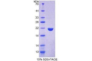 SDS-PAGE (SDS) image for Protein tyrosine Phosphatase, Non-Receptor Type 13 (APO-1/CD95 (Fas)-Associated Phosphatase) (PTPN13) (AA 1-161) protein (His tag) (ABIN6239271)