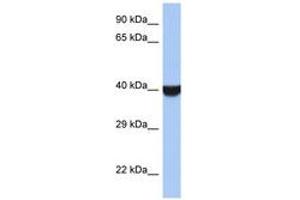 Image no. 1 for anti-Transmembrane Emp24 Protein Transport Domain Containing 8 (TMED8) (AA 251-300) antibody (ABIN6743954) (TMED8 Antikörper  (AA 251-300))