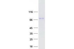 Western Blotting (WB) image for T-Cell Activation rho GTPase-Activating Protein (TAGAP) (Transcript Variant 1) protein (Myc-DYKDDDDK Tag) (ABIN2733205)