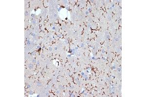 Immunohistochemistry of paraffin-embedded rat brain using //IB Rabbit mAb (9776) at dilution of 1:100 (40x lens). (Iba1 Antikörper)