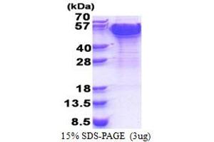 SDS-PAGE (SDS) image for Dynactin 2 (p50) (DCTN2) (AA 1-403) protein (His tag) (ABIN5853400)