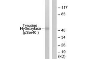 Western blot analysis of extracts from RAW264. (Tyrosine Hydroxylase Antikörper  (pSer71))