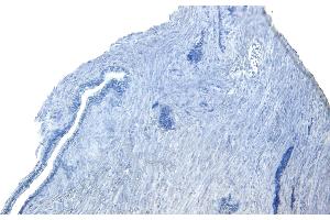 Immunohistochemistry (IHC) image for anti-Receptor Tyrosine Kinase-Like Orphan Receptor 1 (ROR1) (C-Term) antibody (ABIN5539753)