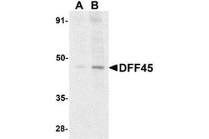 Western blot analysis of DFF45 in HeLa cell lysate with AP30290PU-N DFF45 antibody at (A) 1 and (B) 2 μg/ml. (DFFA Antikörper  (N-Term))