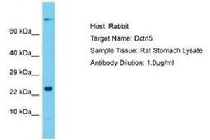 Image no. 1 for anti-Dynactin 5 (p25) (DCTN5) (N-Term) antibody (ABIN6750438)