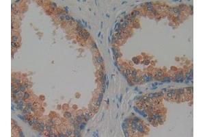 Detection of PRG4 in Human Prostate Tissue using Polyclonal Antibody to Proteoglycan 4 (PRG4)