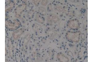 Immunohistochemistry (IHC) image for anti-Keratin 15 (KRT15) (AA 274-399) antibody (ABIN1172997)