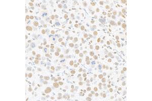 Immunohistochemistry (IHC) image for anti-Mediator Complex Subunit 1 (MED1) (AA 1550-1581) antibody (ABIN7455140) (Rekombinanter MED1 Antikörper  (AA 1550-1581))