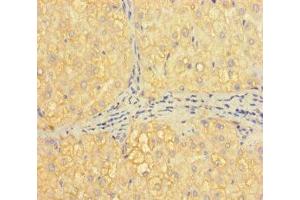 Immunohistochemistry of paraffin-embedded human liver tissue using ABIN7155373 at dilution of 1:100 (H2AFB1 Antikörper  (AA 1-115))
