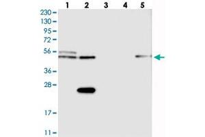 Western blot analysis of Lane 1: RT-4, Lane 2: U-251 MG, Lane 3: Human Plasma, Lane 4: Liver, Lane 5: Tonsil with CDR2L polyclonal antibody  at 1:250-1:500 dilution. (CDR2L Antikörper)