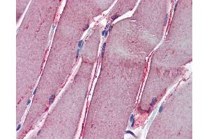 Anti-GSTM2 antibody IHC of human skeletal muscle. (GSTM2 Antikörper  (AA 90-190))