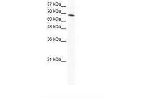 Image no. 1 for anti-DEAD (Asp-Glu-Ala-Asp) Box Polypeptide 1 (DDX1) (AA 671-720) antibody (ABIN202891) (DDX1 Antikörper  (AA 671-720))