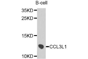Western blot analysis of extracts of B-cell cells, using CCL3L1 antibody. (CCL3L1 Antikörper)