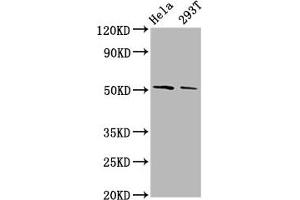 Western Blot Positive WB detected in: Hela whole cell lysate, 293T whole cell lysate All lanes: PLAGL2 antibody at 3. (PLAGL2 Antikörper  (AA 324-469))