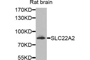 Western blot analysis of extracts of rat brain, using SLC22A2 antibody.
