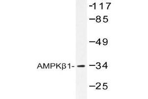 Western blot (WB) analysis of AMPKβ1 antibody in extracts from RAW264. (PRKAB1 Antikörper)