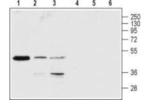 Western blot analysis of rat brain (lanes 1 and 4), Jurkat (lanes 2 and 5) and K-562 (lanes 3 and 6) lysates: - 1-3. (P2RY1 Antikörper  (2nd Extracellular Loop))
