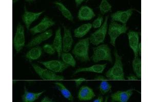 Immunofluorescence analysis of L929 cells using RAPGEF1 Polyclonal Antibody at dilution of 1:100 (40x lens). (GRF2 Antikörper)