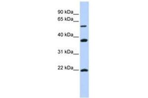 Image no. 1 for anti-Myosin Regulatory Light Chain Interacting Protein (MYLIP) (AA 360-409) antibody (ABIN6743161) (MYLIP Antikörper  (AA 360-409))