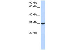 WB Suggested Anti-RNF182 Antibody Titration:  0. (RNF182 Antikörper  (Middle Region))