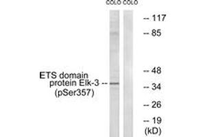 Western blot analysis of extracts from COLO205 cells treated with serum 20% 15', using Elk3 (Phospho-Ser357) Antibody. (ELK3 Antikörper  (pSer357))