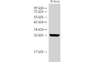 Western Blot analysis of Rat liver using GSTA1 Polyclonal Antibody at dilution of 1:3000 (GSTA1 Antikörper)