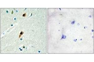 Immunohistochemistry analysis of paraffin-embedded human brain tissue, using RBM5 Antibody. (RBM5 Antikörper  (AA 226-275))