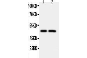 Anti-Caspase-2 antibody, Western blotting Lane 1: CEM Cell Lysate Lane 2: SMMC Cell Lysate
