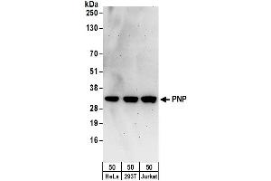 Western Blotting (WB) image for anti-Purine Nucleoside Phosphorylase (PNP) (AA 239-289) antibody (ABIN7450576)