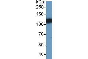 Detection of EPHA4 in Porcine Cerebrum lysate using Polyclonal Antibody to Ephrin Type A Receptor 4 (EPHA4) (EPH Receptor A4 Antikörper  (AA 621-882))