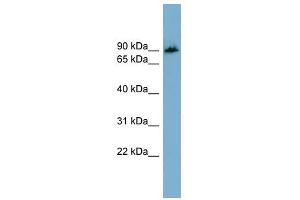 APBB1IP antibody used at 1 ug/ml to detect target protein. (Amyloid beta (A4) Precursor Protein-Binding, Family B, Member 1 Interacting Protein (APBB1IP) (N-Term) Antikörper)