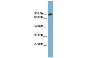 Western Blotting (WB) image for anti-Amyloid beta (A4) Precursor Protein-Binding, Family B, Member 1 Interacting Protein (APBB1IP) (N-Term) antibody (ABIN632668)
