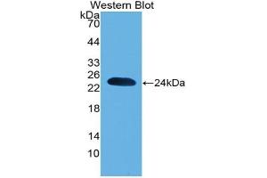 Detection of Recombinant PARK7, Mouse using Polyclonal Antibody to Parkinson Disease Protein 7 (PARK7) (PARK7/DJ1 Antikörper  (AA 1-189))