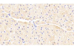 Detection of TNNC1 in Human Cardiac Muscle Tissue using Polyclonal Antibody to Troponin C Type 1, Slow (TNNC1) (TNNC1 Antikörper  (AA 1-161))