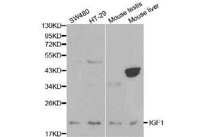 Western blot analysis of extracts of various cell lines, using IGF1 antibody. (IGF1 Antikörper  (C-Term))