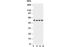 Western blot testing of Glut5 antbody;  Lane 1: U87;  2: 293T;  3: HT1080;  4: SW620 cell lysate (SLC2A5 Antikörper  (AA 481-501))