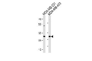 ASB11 Antibody (N-term) (ABIN1881072 and ABIN2843226) western blot analysis in MDA-MB-231,MDA-MB-453 cell line lysates (35 μg/lane). (ASB11 Antikörper  (N-Term))