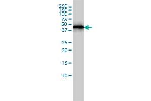 ACTR3 monoclonal antibody (M02), clone 2B6 Western Blot analysis of ACTR3 expression in A-431 . (ACTR3 Antikörper  (AA 1-418))
